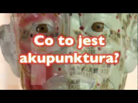 Akupunktura – co to jest akupunktura?